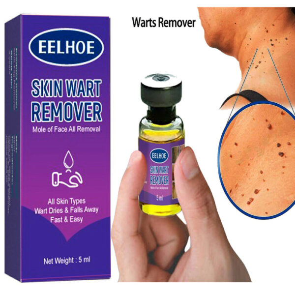 Achil Remover - Image 1